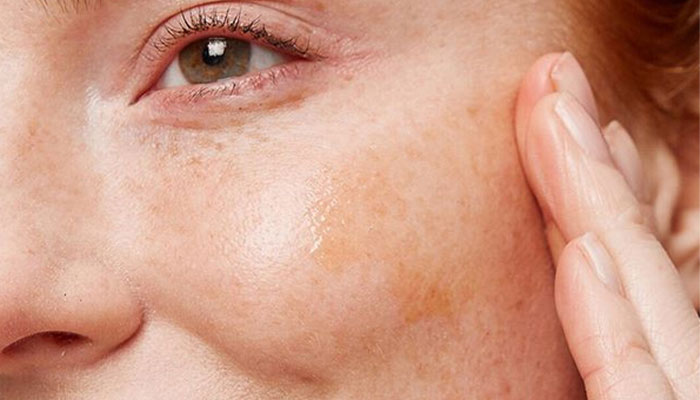 Femme appliquant un soin hydratant pour peau sèche